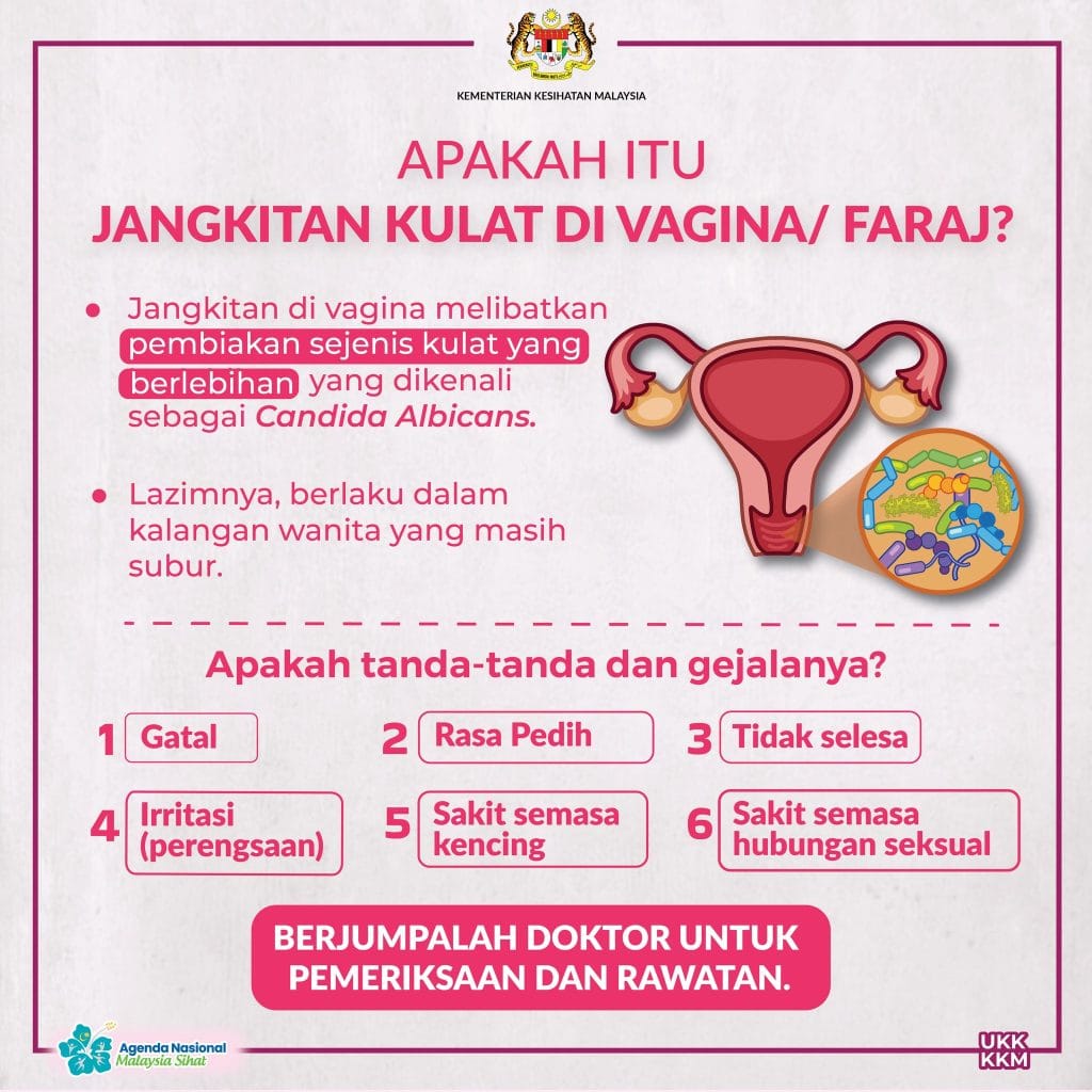 punca keputihan wanita kkm