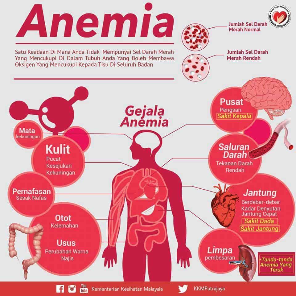 penyakit anemia