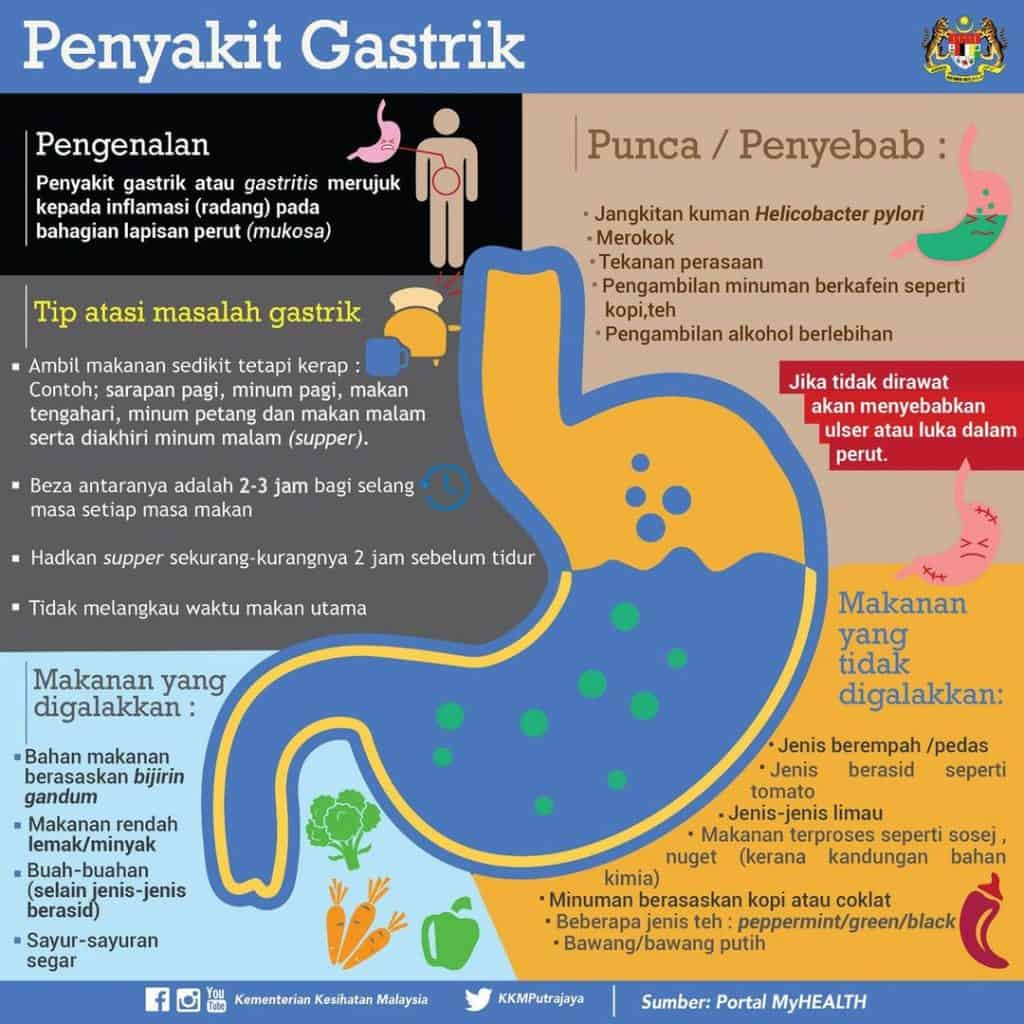 punca gastrik