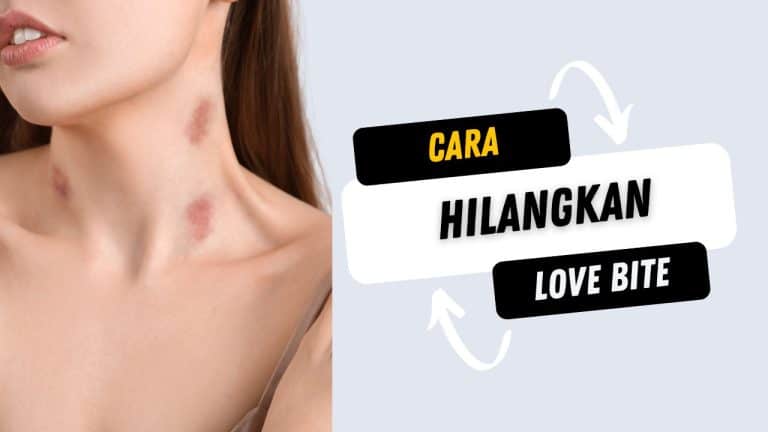 cara hilangkan love bite