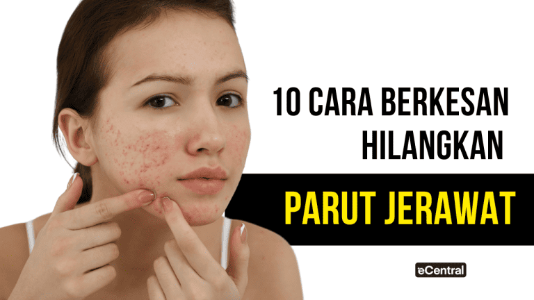 cara hilangkan parut jerawat