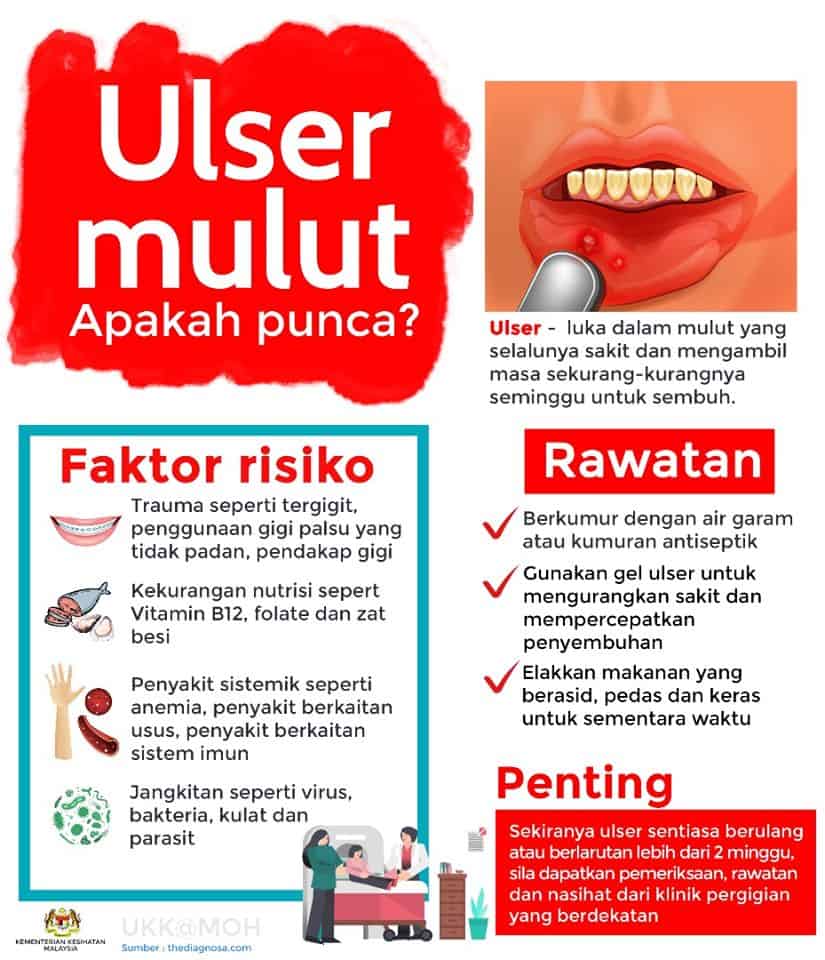 Ulser mulut