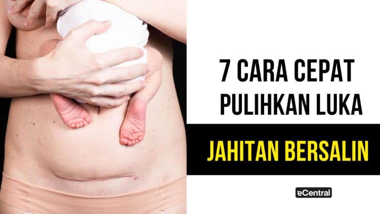 luka jahitan bersalin